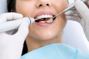 Dentist performing professional dental scaling and polishing for a patient in Singapore
