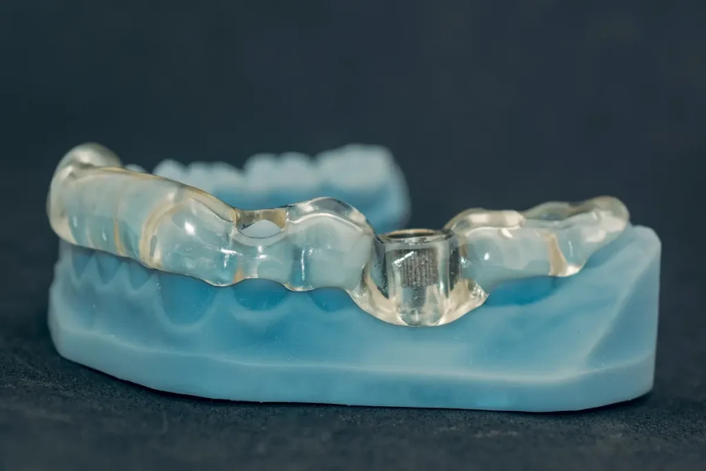 Customised 3D-printed surgical guide used for computer-guided dental implant placement